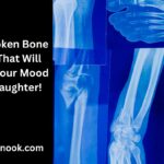 164 Broken Bone Puns That Will Mend Your Mood with Laughter!