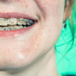Impact of Orthodontics