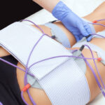 Electrical Muscle Stimulation for Body Sculpting